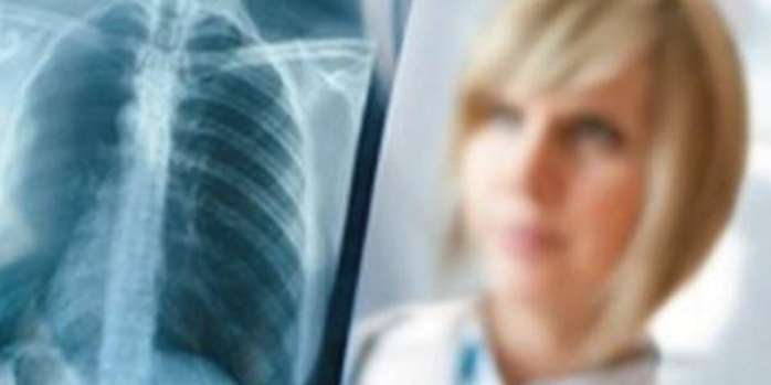 Akciğer Kanserinin Cerrahi Yöntemlerle Tedavisi